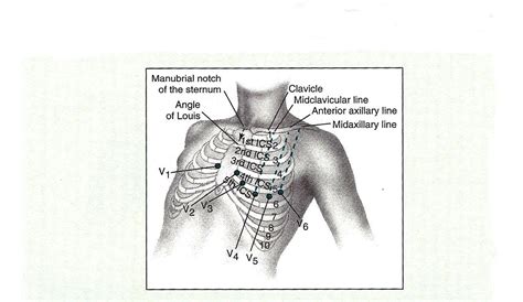 12 Lead Ekg Reading Ekg Nurse Quotes Ekg Placement