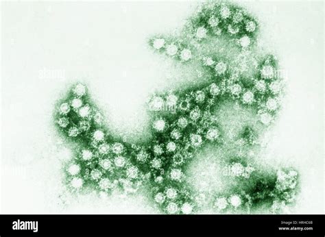 Micrografia De Inmunoelectron Fotografías E Imágenes De Alta Resolución Alamy