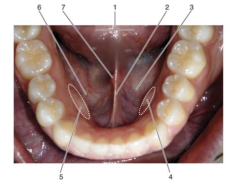 Normal Floor Of Mouth Photos