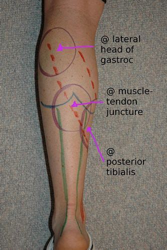 Achilles Tendon And Calf Anatomy Muscles Massage Physical Therapy Achilles Tendonitis