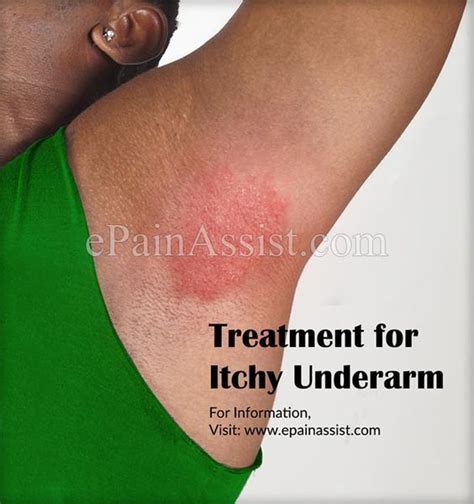 Itchy Rash Under Armpit