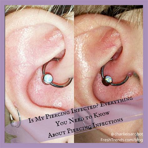 Is My Piercing Infected Everything You Need To Know About Piercing Infections Piercing