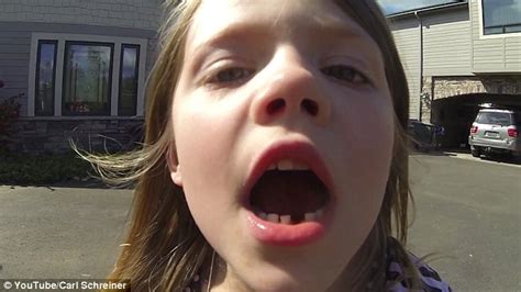 Carl Schreiner Whips Out His Daughters Wobbly Tooth With