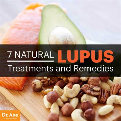 Top 7 Natural Lupus Treatments And Remedies