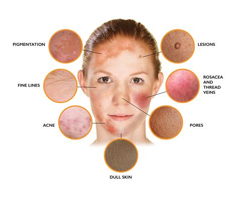 Types Of Skin Problems On Face