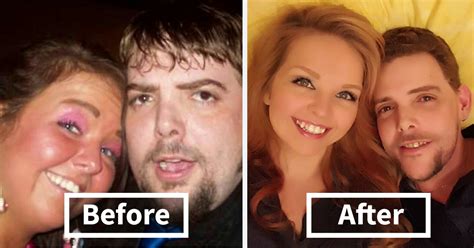 Before And After Pics Show What Happens When You Stop Drinking