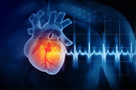 Mengenal Dan Cara Mencegah Henti Jantung Penyebab Kematian Terbesar Di Amerika Serikat News