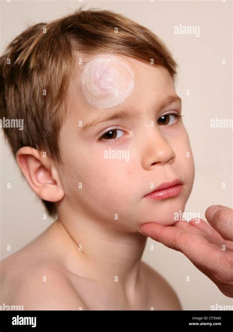 Child With Hematoma Stock Photo Alamy
