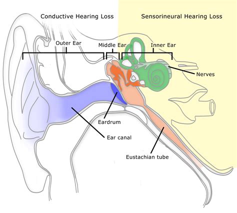 Hearing Loss Tinnitus And Imbalance Vertigo