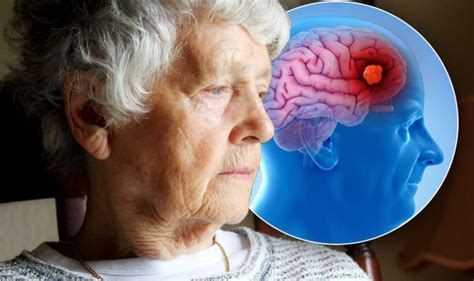 Vascular Dementia Symptoms Signs Of Brain Condition Include Memory