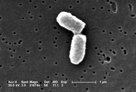 Free Picture Dividing Escherichia Coli Bacteria Clearly Display