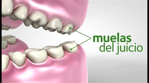 ¿qué Son Muelas De Juicio Video De Mouth Healthy Dra María López