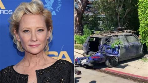 Actress Anne Heche Presumed To Be Under The Influence During Fiery
