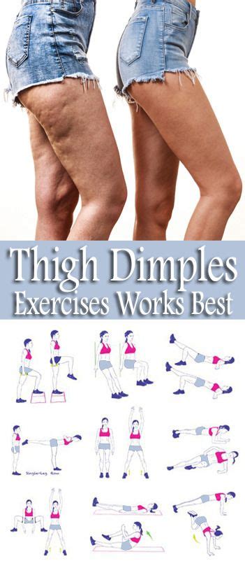 8 Simple Amp Best Exercises To Get Rid Of Thigh Dimples Dimpled Skin