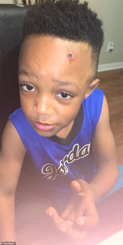 Mother Horrified After Son Returns Home From School With A Bullet Wound
