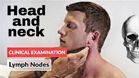 Clinical Examination Head And Neck Lymph Nodes Youtube