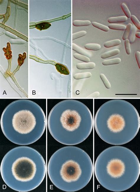 The Colletotrichum Gloeosporioides Species Complex Scienceopen