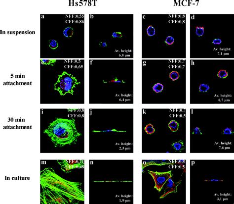 Differential Nuclear Shape Dynamics Of Invasive Andnon Invasive Breast