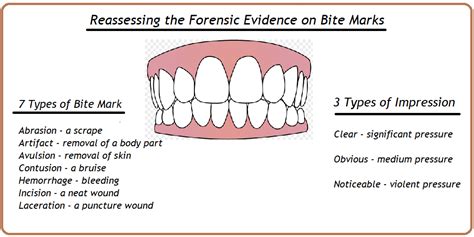 Reassessing The Forensic Evidence On Bite Marks Mozartcultures