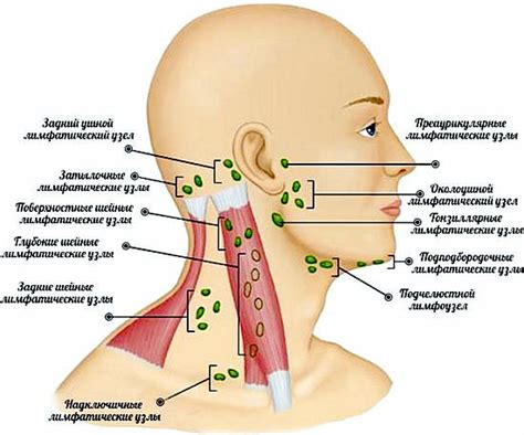 Inflammation des ganglions lymphatiques sur le cou traitement symptômes de la lymphadénite