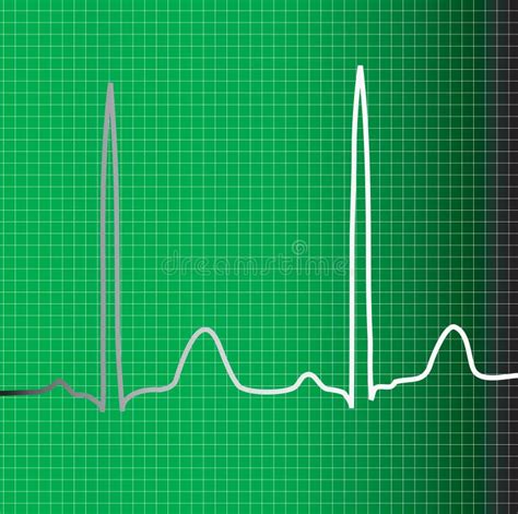 Heartbeat Normal Ecg Graph Stock Illustration Illustration Of Muscular