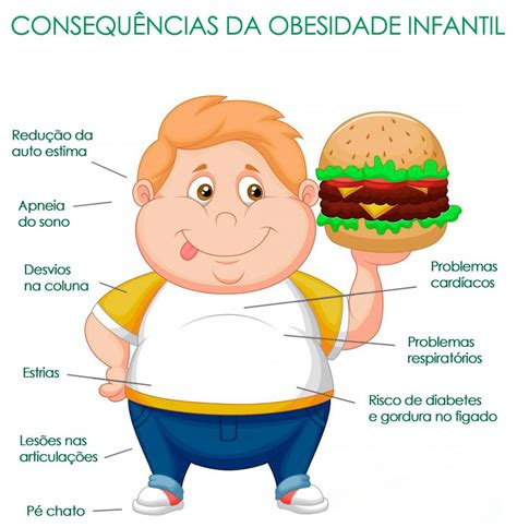 Em Dia De Conscientiza O M Dicos Alertam Sobre Obesidade Infantil Vis O Not Cias A