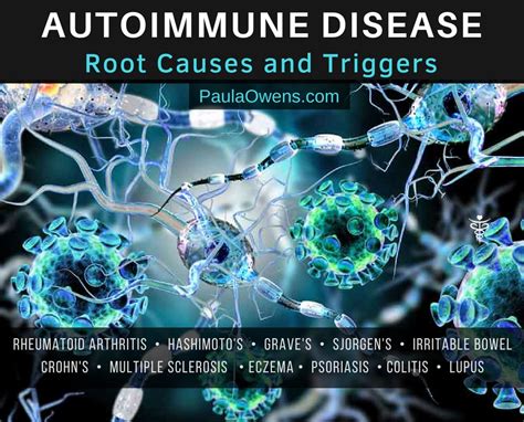 Autoimmune Disease Root Causes And Triggers Paula Owens Ms Clinical
