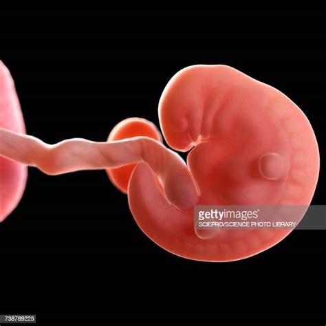 6 Weeks Fetus Photos And Premium High Res Pictures Getty Images