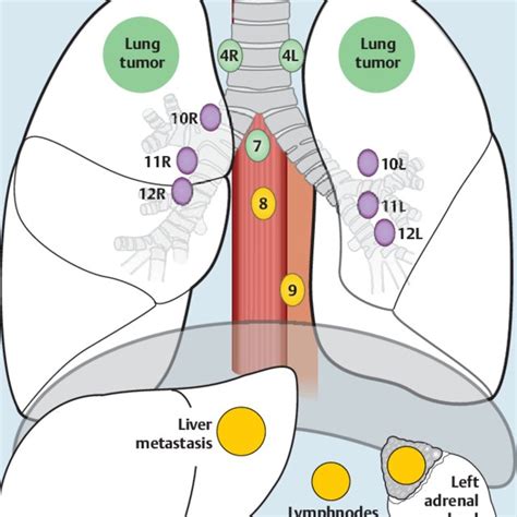 Illustration Of Mediastinal Lymph Node Stations And Abdominal Regions