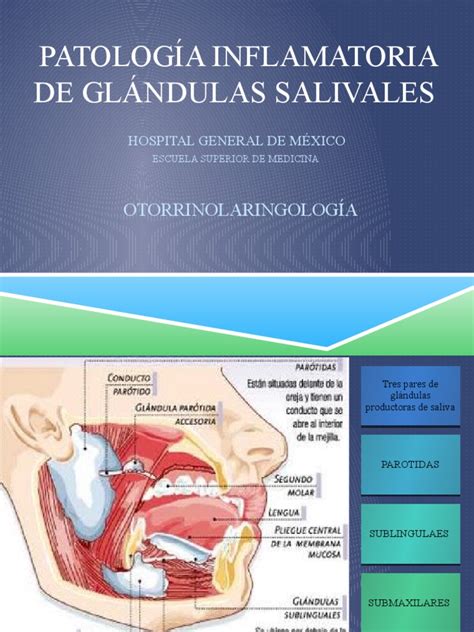 Patología Inflamatoria De Glándulas Salivales Pdf