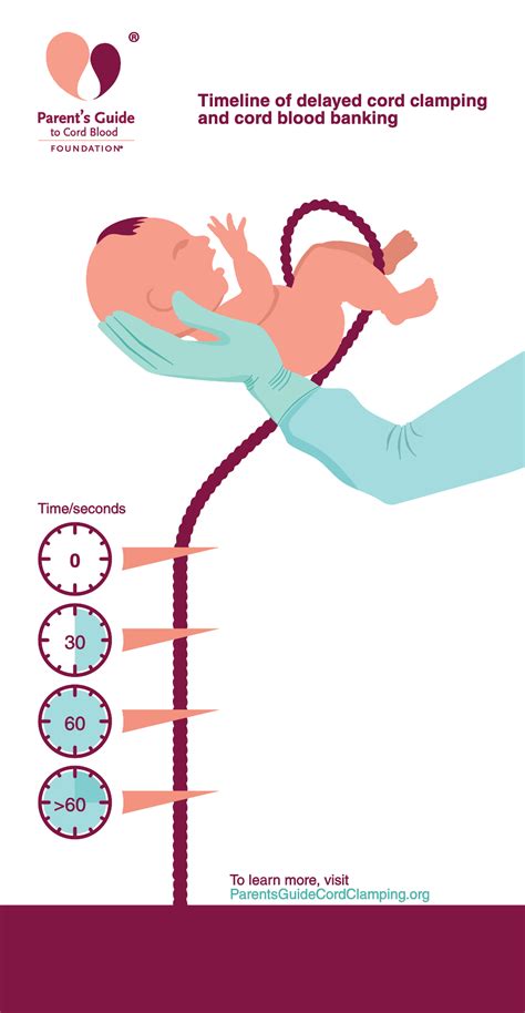 What Is Delayed Cord Clamping