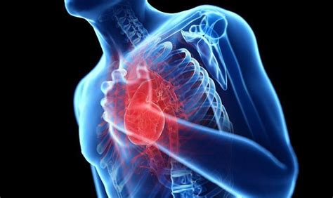 Untuk memastikan penyakit jantung bisa dilihat dari hasil diagnosis dokter. Ini Penyebab Jantung Koroner dan Cara Pencegahannya