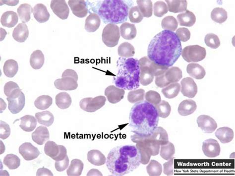 Clinical Significance Of Blood Formation In Basophils Monocytes