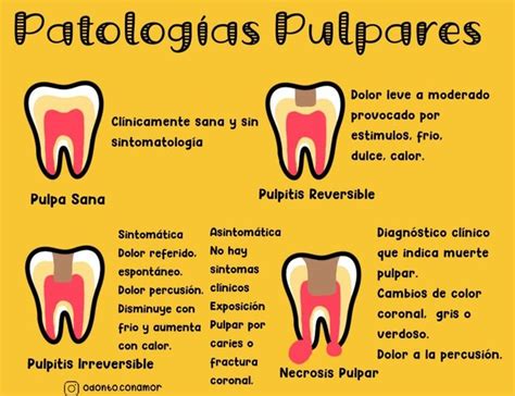 Odonto Con Amor🦷 On Instagram “patologÍas Pulpares 🦷 Odontocomamor