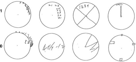 Don't forget to bookmark this page by hitting (ctrl + d), Clock Drawing Test | Neupsy Key