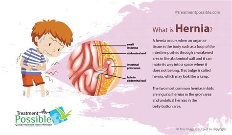 Pediatric Hernia Treatment In India Treatment Possible