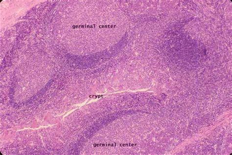 Pharyngeal Tonsil Histology Labeled 630 The Best Porn Website