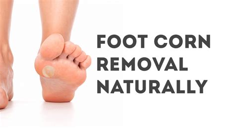 Foot Corn Removal Remedies Foot Care Tips