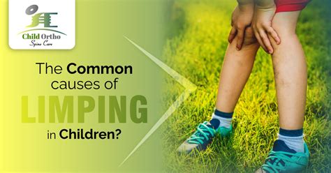 The Common Causes Of Limping In Children