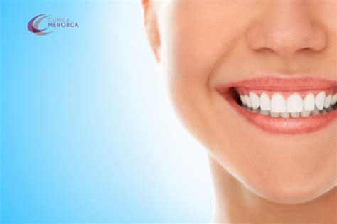 Consejos De Salud Bucal 5 Tips Para Librarse Del Dentista