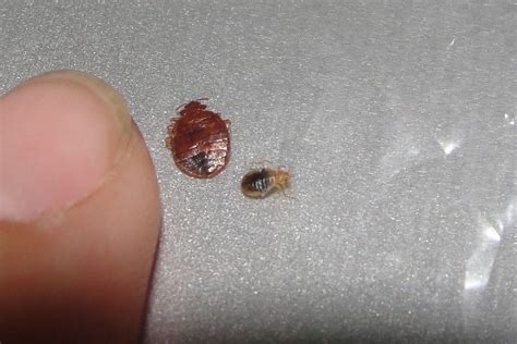 Baby Bed Bug Bites Pictures Clothed With Authority Online Diary Photo