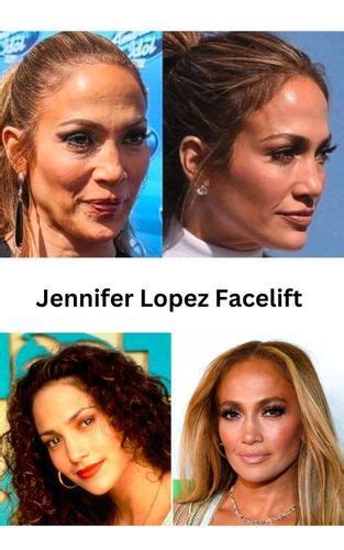 Jennifer Lopez Plastic Surgery Secrets Full Guide 2023 Fabbon