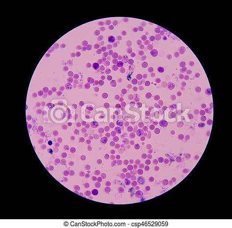 Reticulocyte With Red Blood Cells On Blood Smear Canstock
