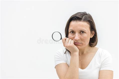 Close Up Photo Of Woman With Dry Skin With Magnifying Glass Stock