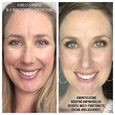 Beforeafter Rodanfields Redefine Reverse And Lash Boost Rodan And