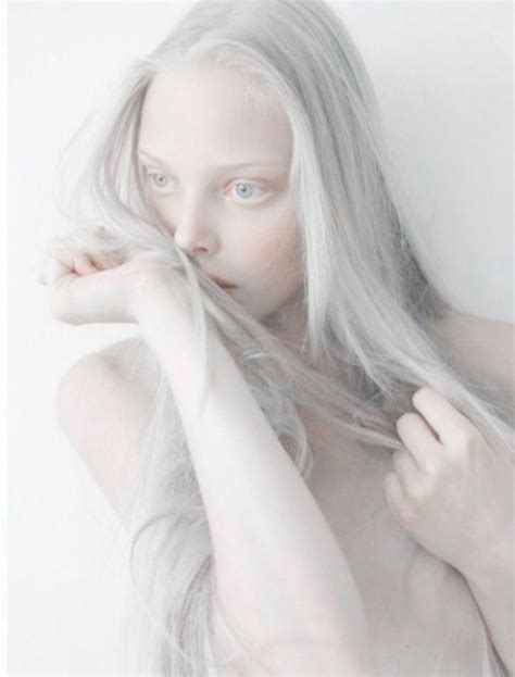 У матери неполный альбинизм белоснежные волосы с серо зелёными глазами