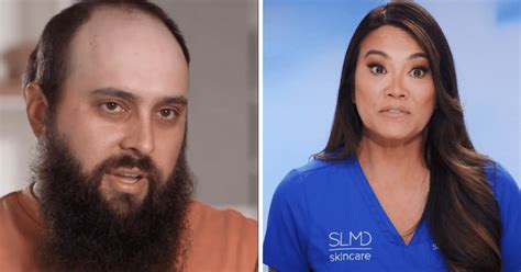 Where Is Mike Now Dr Pimple Popper Patient Wanted To Get Rid Of Head