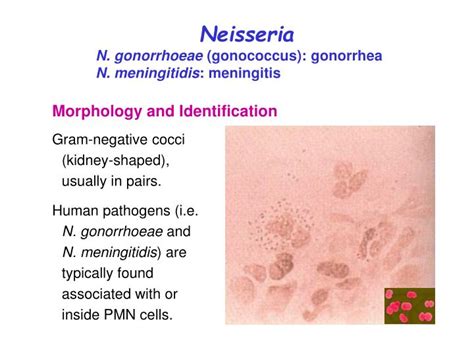 Neisseria gonorrhoeae входят в семейство neisseriaceae, род neisseria. PPT - Neisseria N. gonorrhoeae (gonococcus): gonorrhea N ...