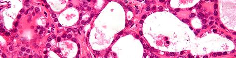 Nhs england hopes the blood test will be particularly useful in identifying types of cancer that are currently difficult to diagnose and treat early. Study to determine if early cancer can be detected with ...