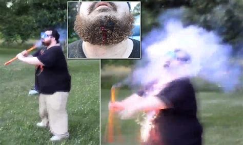 Indiana Man Lights Firework Underneath His Own Chin And Leaves Him With